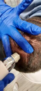 Kozmetika EPN-arcfiatalítás-hajas-fejbőr-kezelése-slim-beauty-siófok
