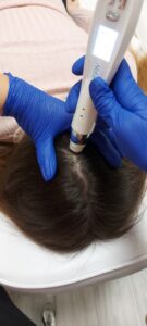 Kozmetika EPN-arcfiatalítás-hajas-fejbőr-kezelése-slim-beauty-siófok